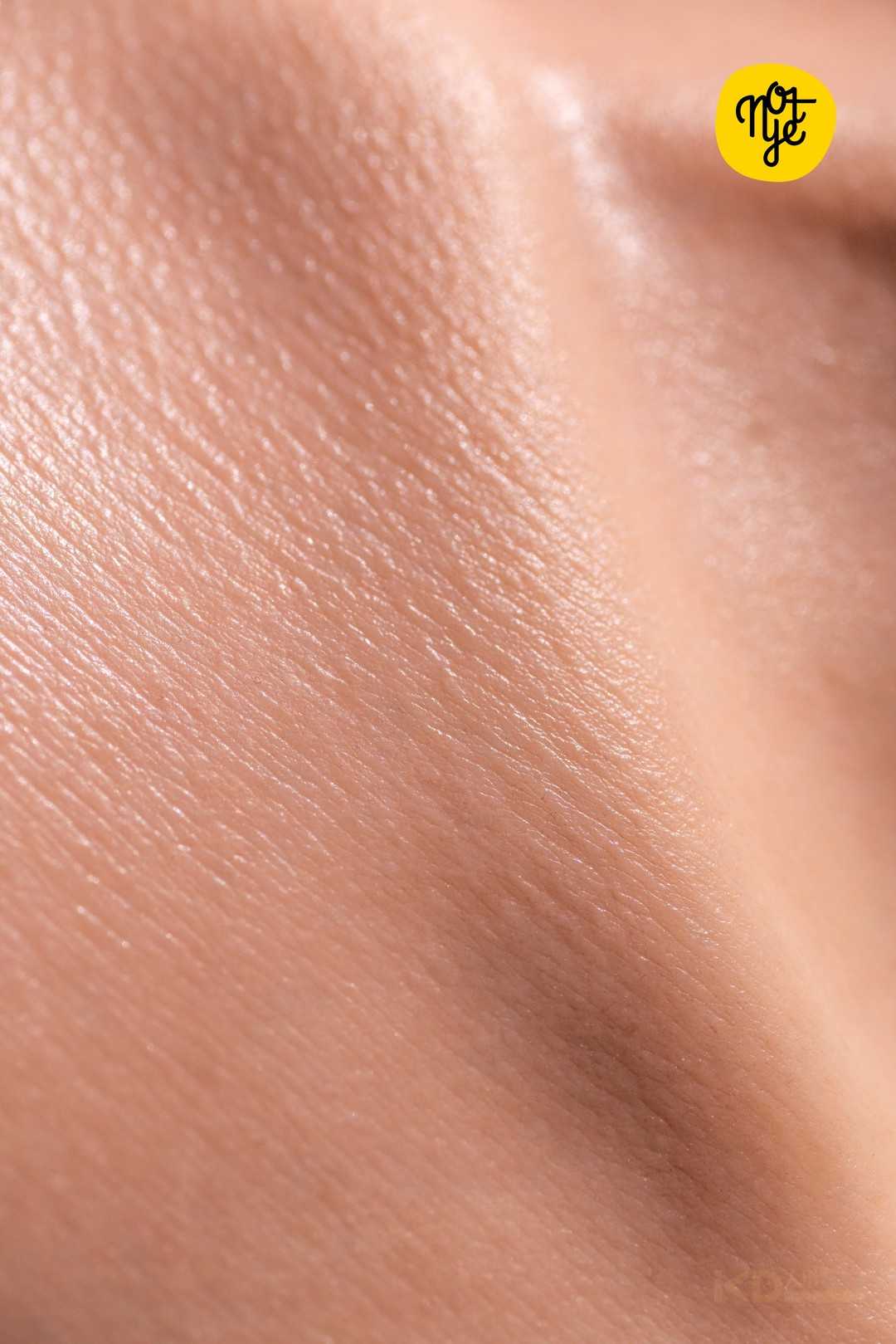 notye breast skin s5-2 (7).JPG